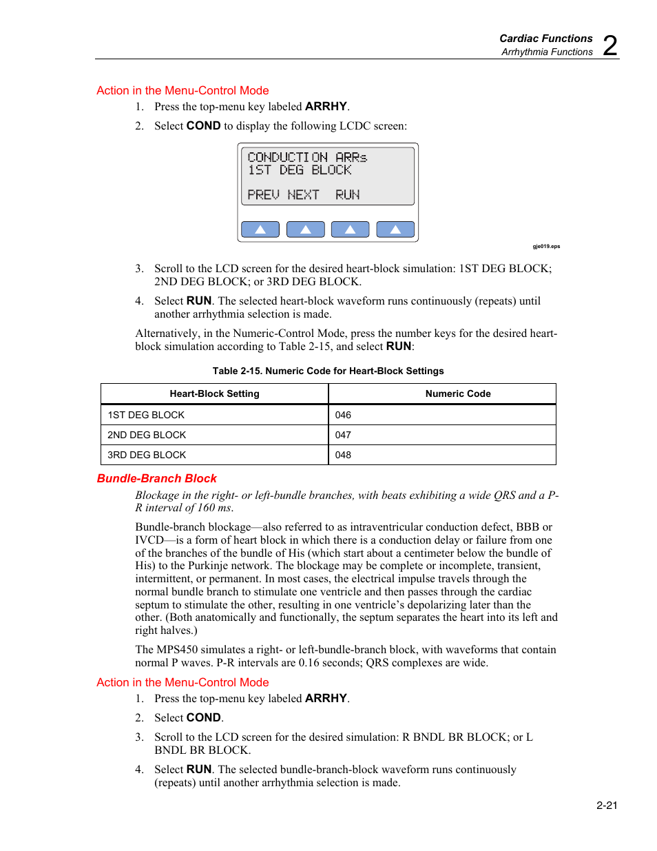 Bundle-branch block | Fluke Biomedical MPS450 User Manual | Page 53 / 126