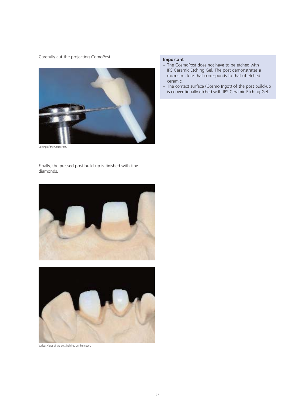 Ivoclar Vivadent CosmoPost User Manual | Page 22 / 24