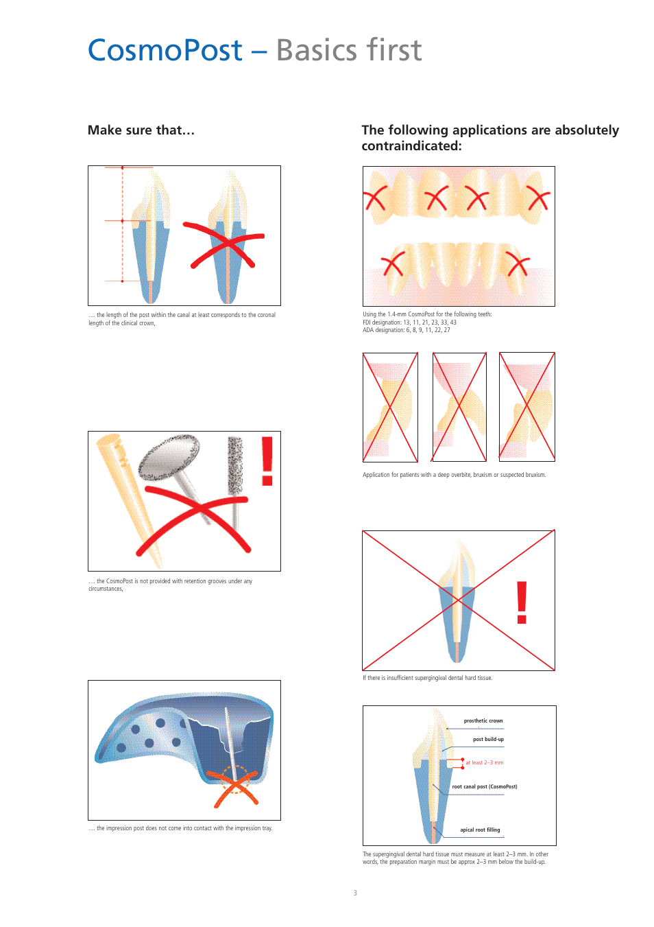 Cosmopost – basics first | Ivoclar Vivadent CosmoPost User Manual | Page 3 / 24