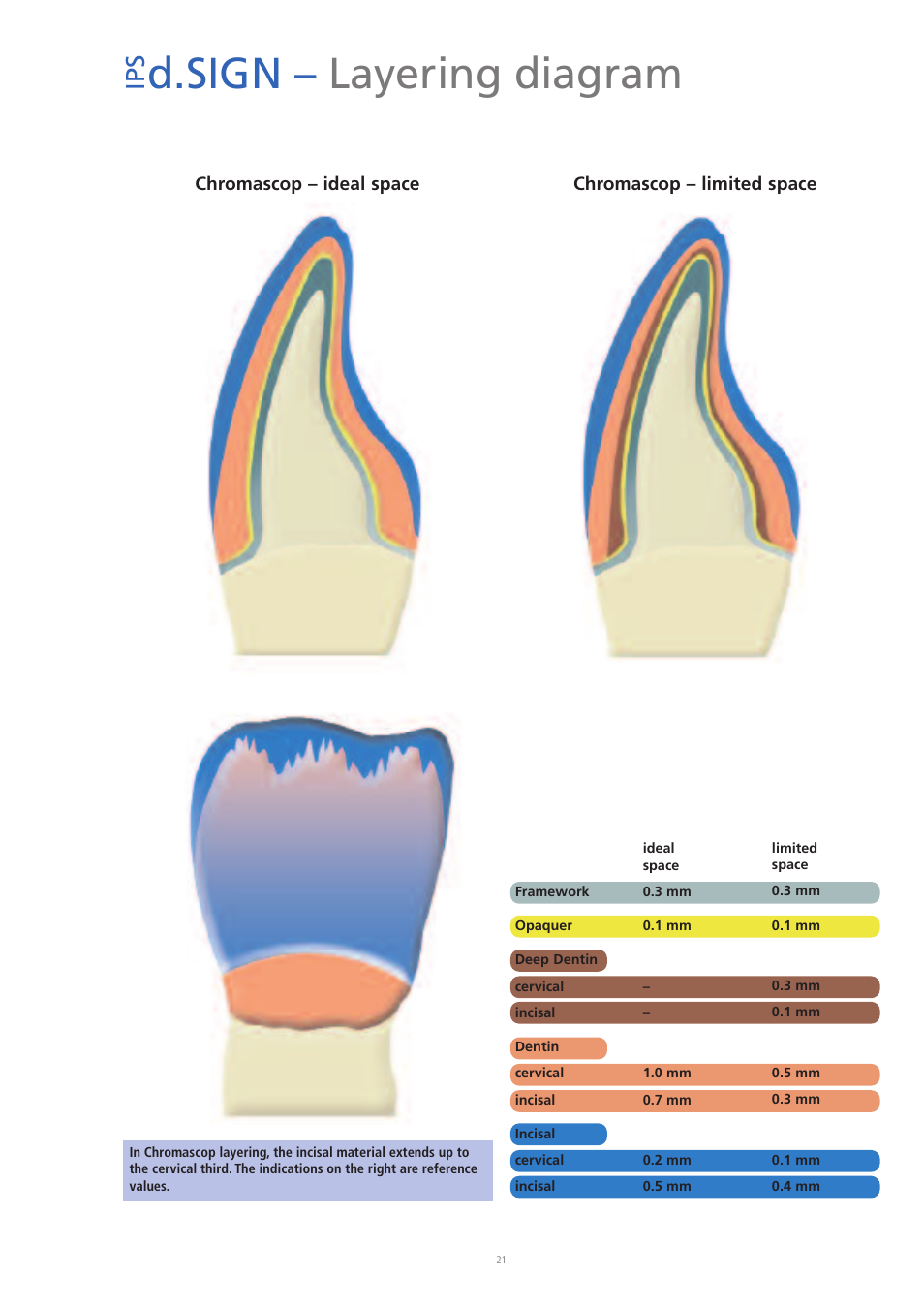 D.sign – layering diagram, Ip s | Ivoclar Vivadent IPS d.SIGN User Manual | Page 21 / 68