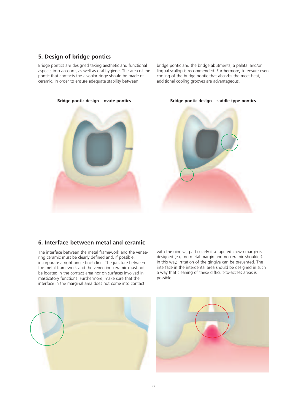 Design of bridge pontics, Interface between metal and ceramic | Ivoclar Vivadent IPS d.SIGN User Manual | Page 27 / 68