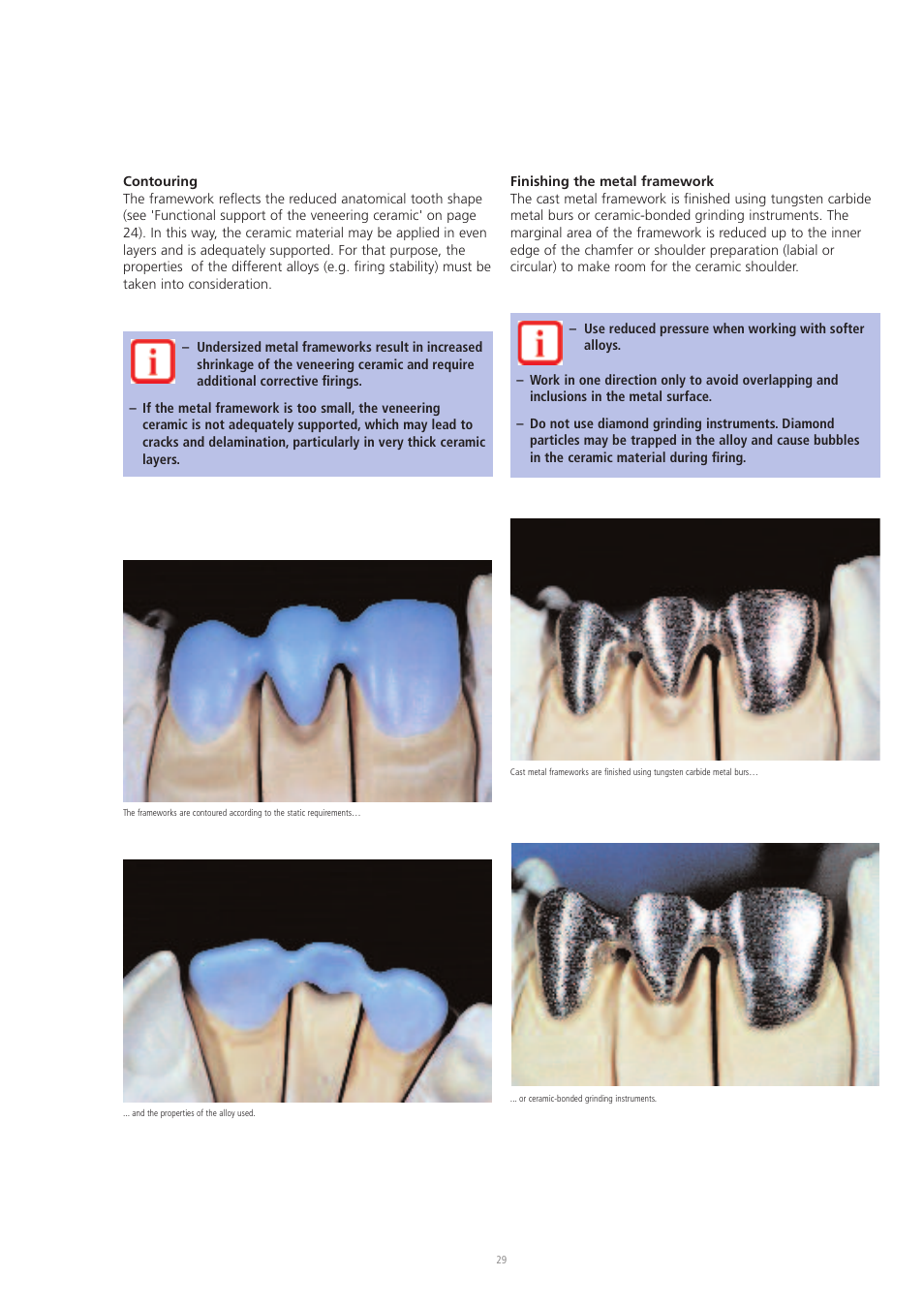Ivoclar Vivadent IPS d.SIGN User Manual | Page 29 / 68