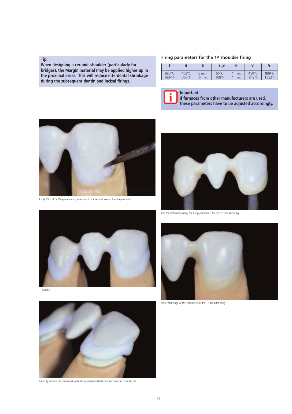 Ivoclar Vivadent IPS d.SIGN User Manual | Page 35 / 68