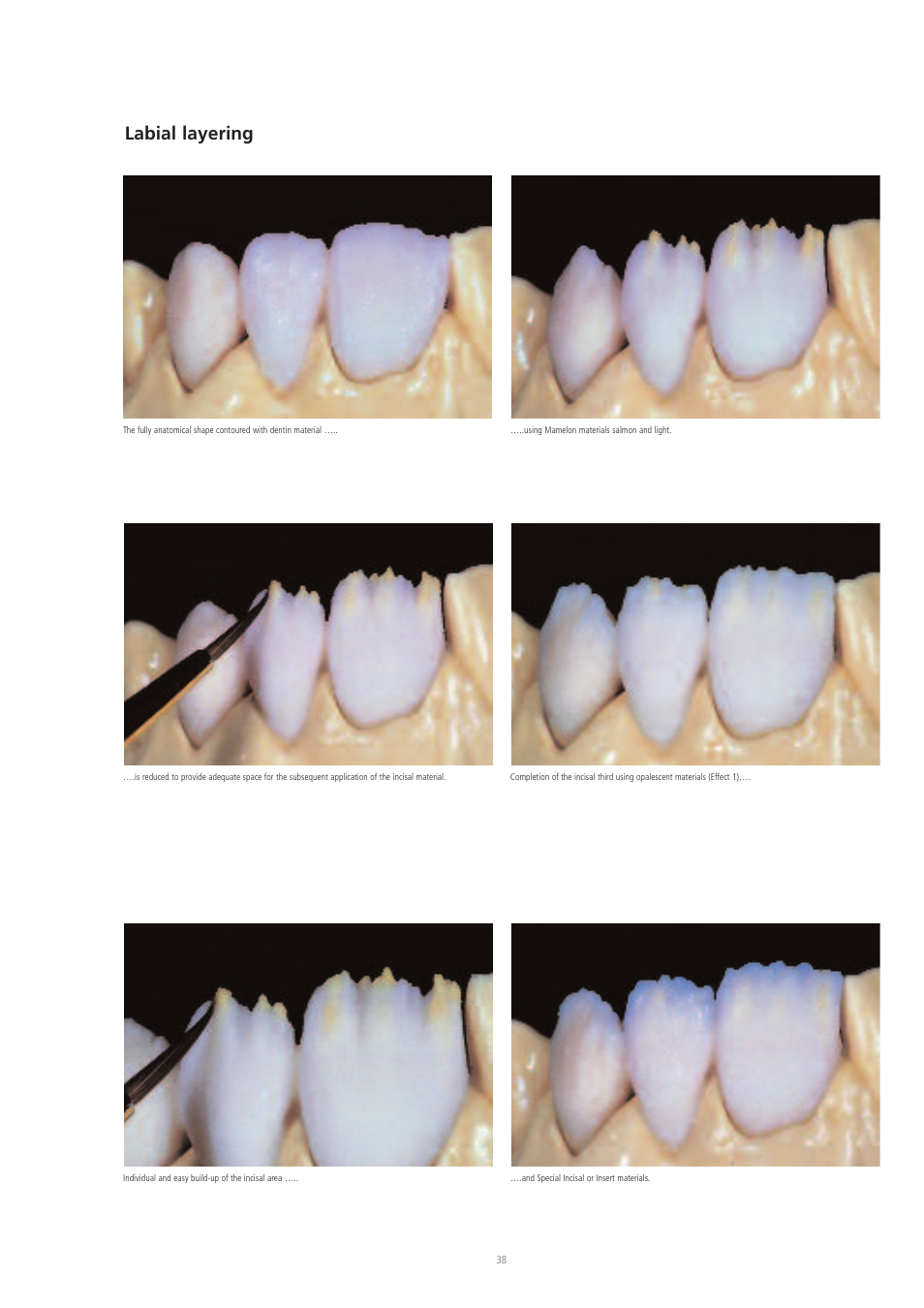 Labial layering | Ivoclar Vivadent IPS d.SIGN User Manual | Page 38 / 68