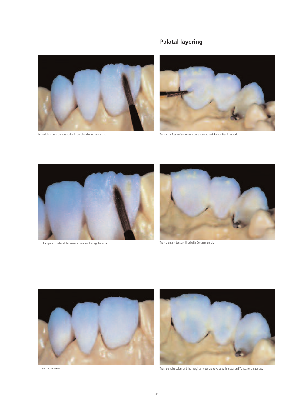 Palatal layering | Ivoclar Vivadent IPS d.SIGN User Manual | Page 39 / 68