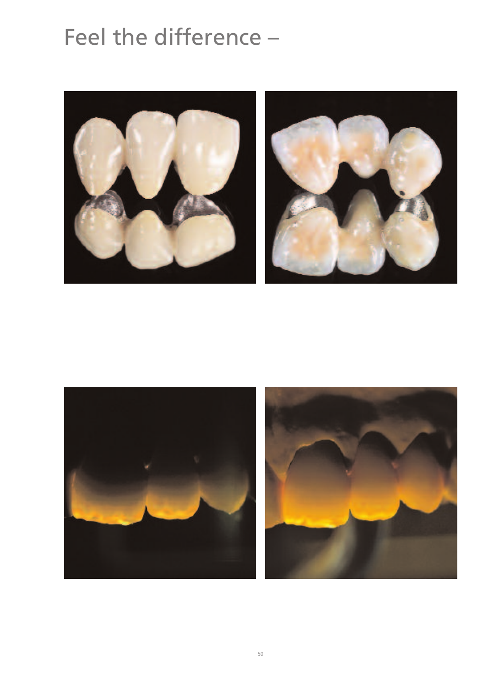 Feel the difference | Ivoclar Vivadent IPS d.SIGN User Manual | Page 50 / 68