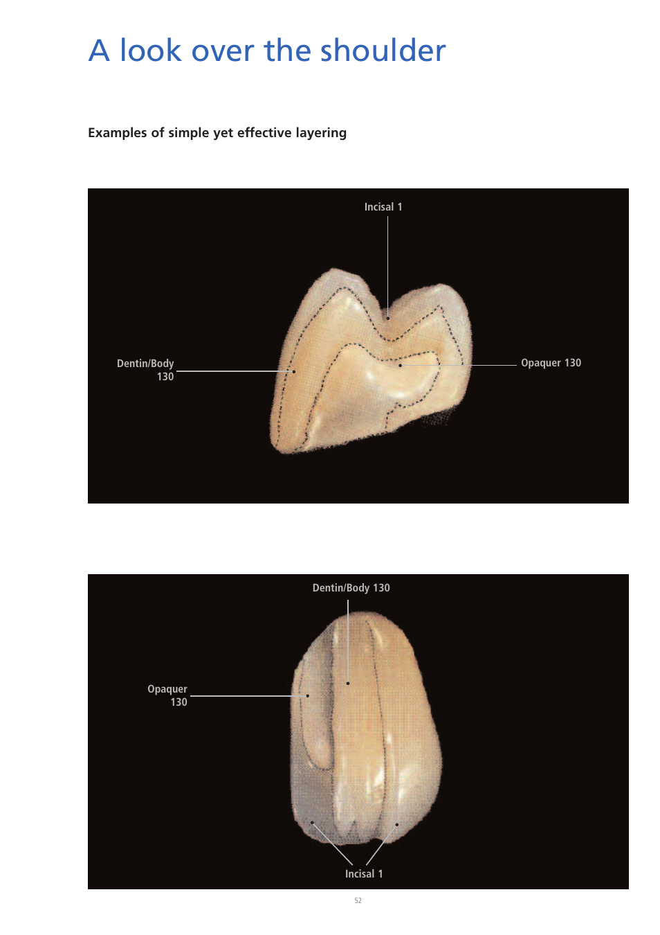A look over the shoulder, Examples of simple yet effective layering | Ivoclar Vivadent IPS d.SIGN User Manual | Page 52 / 68