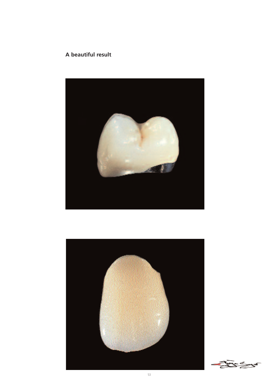 A beautiful result | Ivoclar Vivadent IPS d.SIGN User Manual | Page 53 / 68