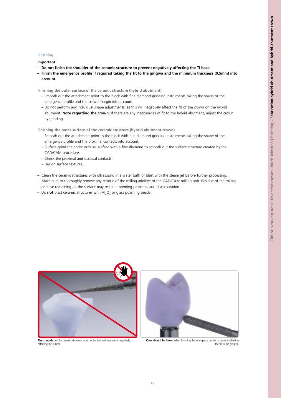 Ivoclar Vivadent IPS e.max CAD Abutment Solutions User Manual | Page 15 / 66