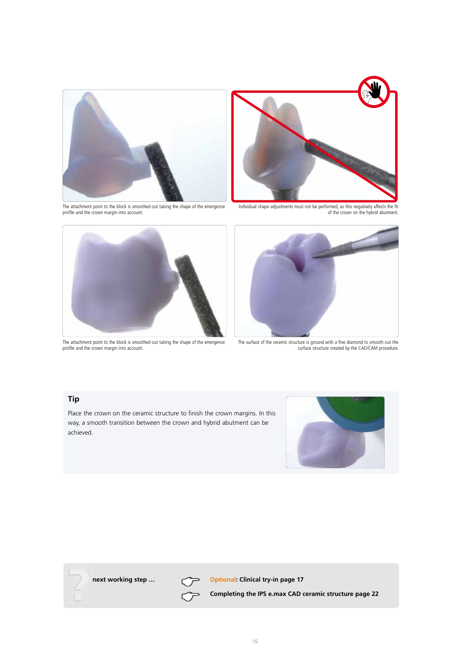 Ivoclar Vivadent IPS e.max CAD Abutment Solutions User Manual | Page 16 / 66