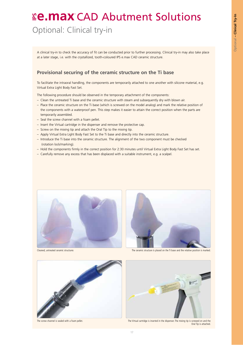Cad abutment solutions, Optional: clinical try-in | Ivoclar Vivadent IPS e.max CAD Abutment Solutions User Manual | Page 17 / 66