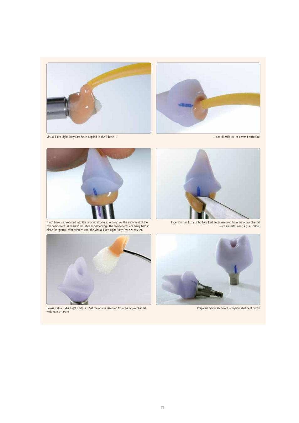 Ivoclar Vivadent IPS e.max CAD Abutment Solutions User Manual | Page 18 / 66