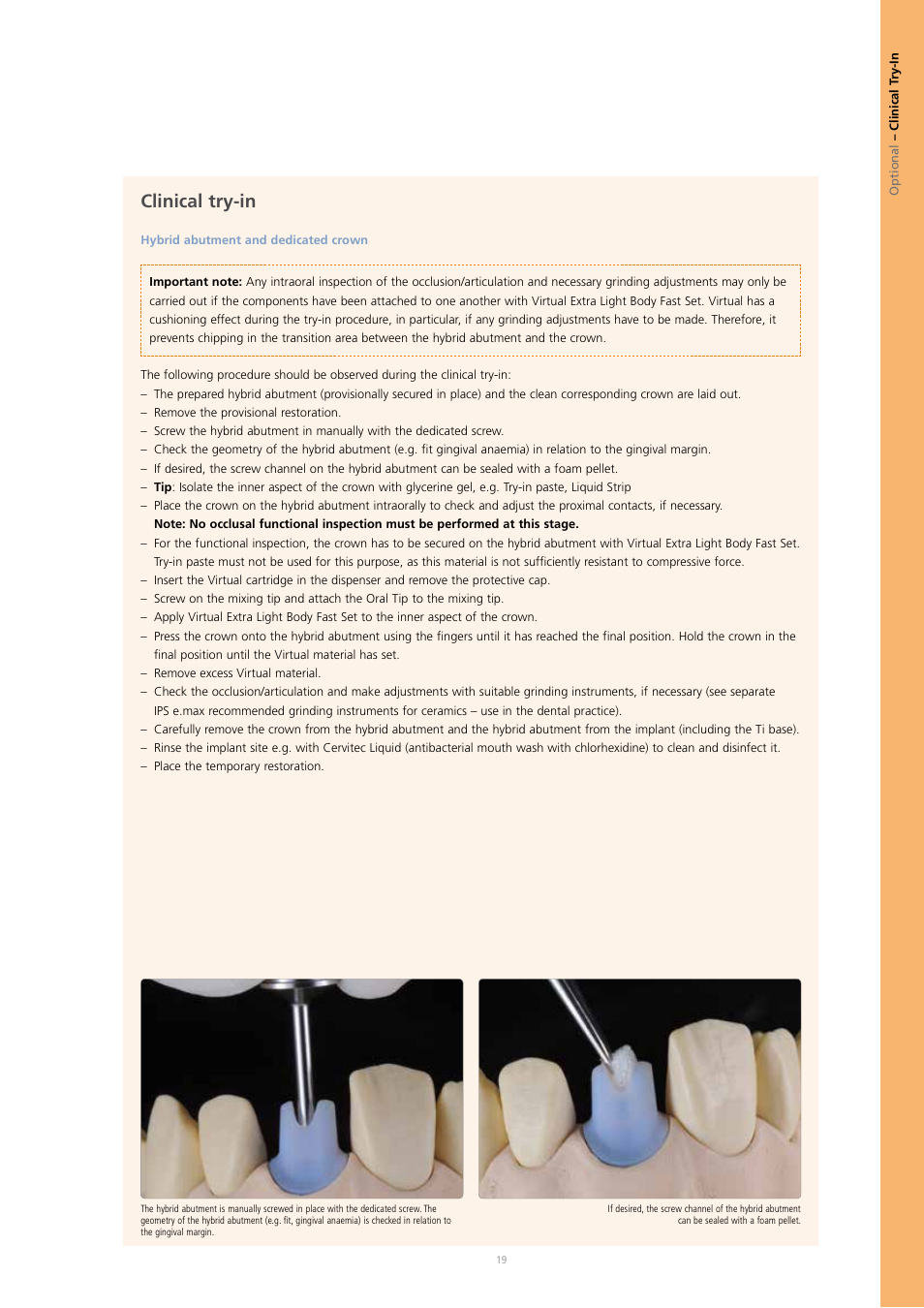 Clinical try-in | Ivoclar Vivadent IPS e.max CAD Abutment Solutions User Manual | Page 19 / 66