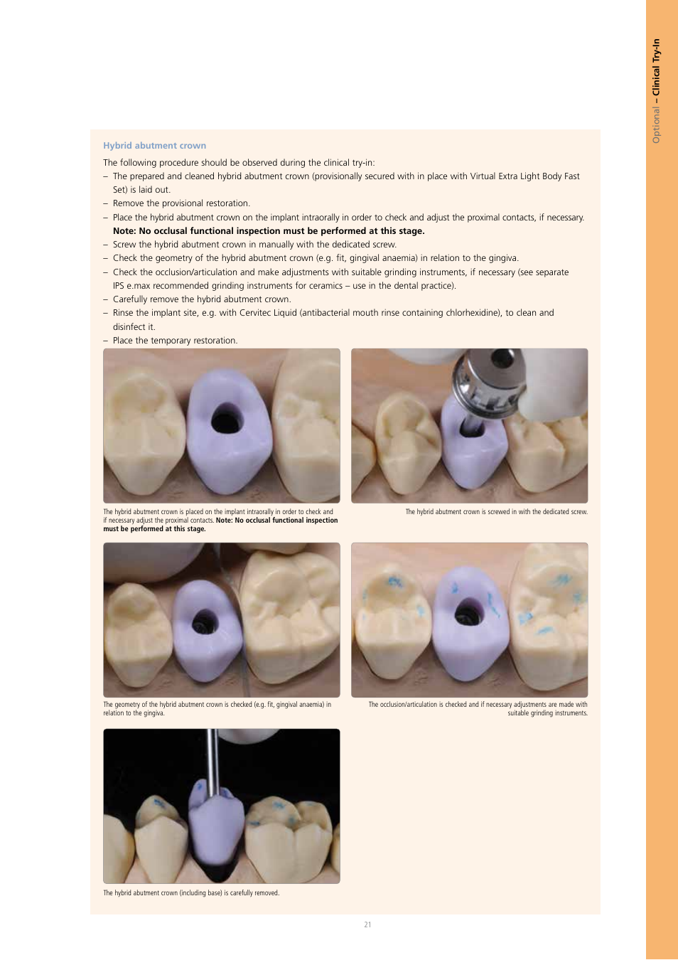 Ivoclar Vivadent IPS e.max CAD Abutment Solutions User Manual | Page 21 / 66