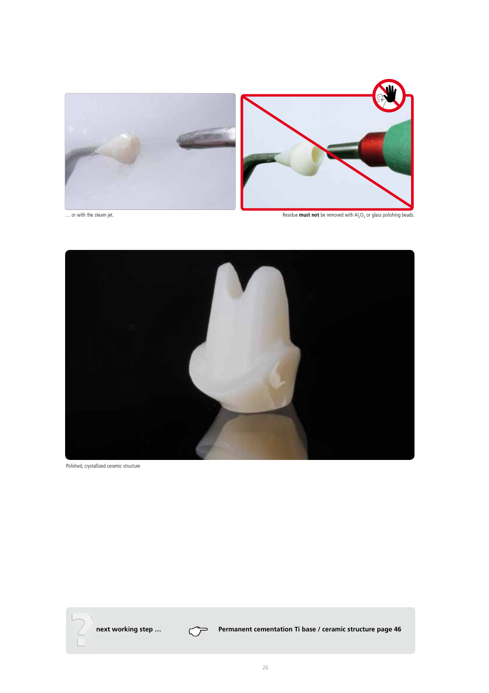 Ivoclar Vivadent IPS e.max CAD Abutment Solutions User Manual | Page 26 / 66