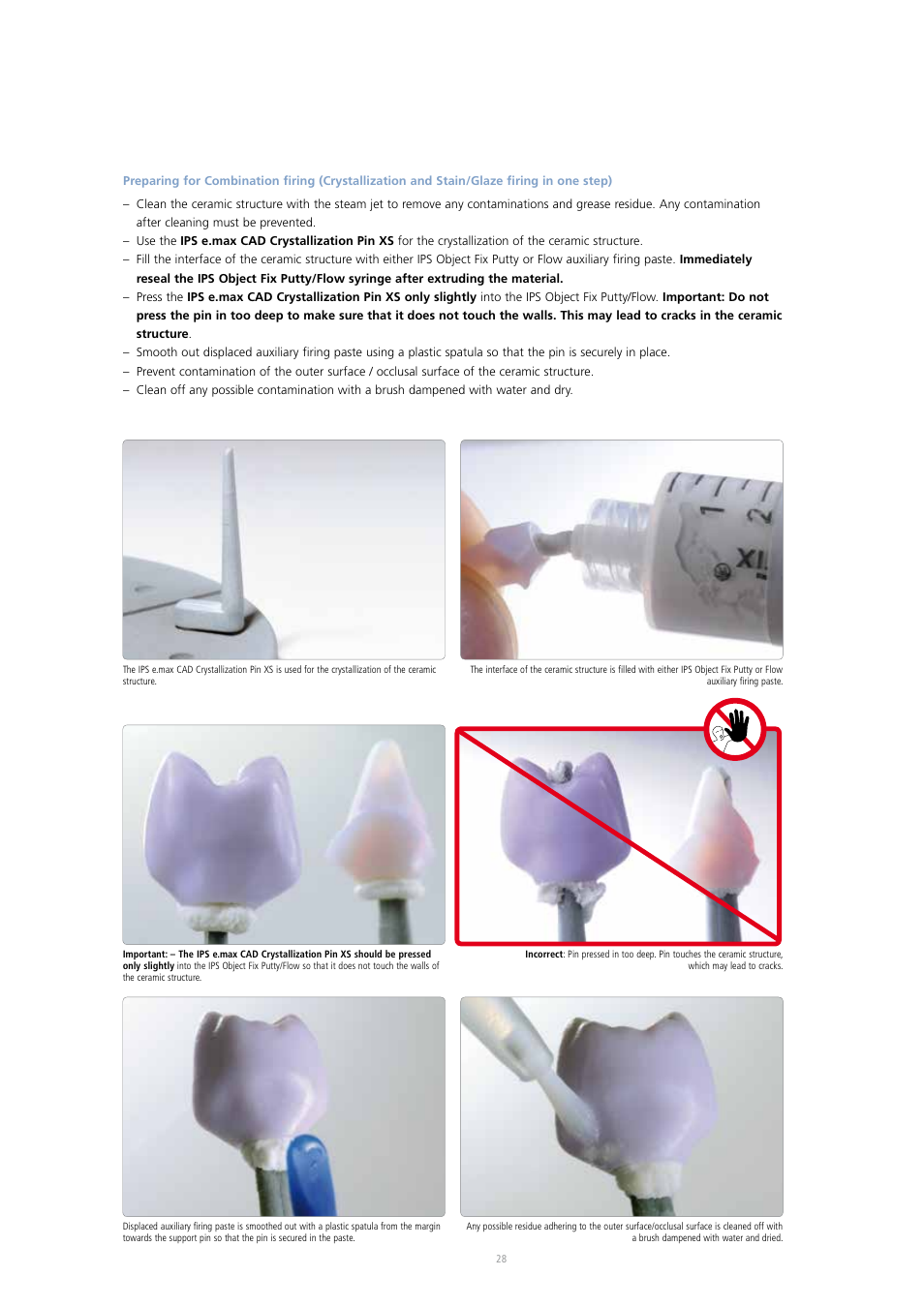 Ivoclar Vivadent IPS e.max CAD Abutment Solutions User Manual | Page 28 / 66