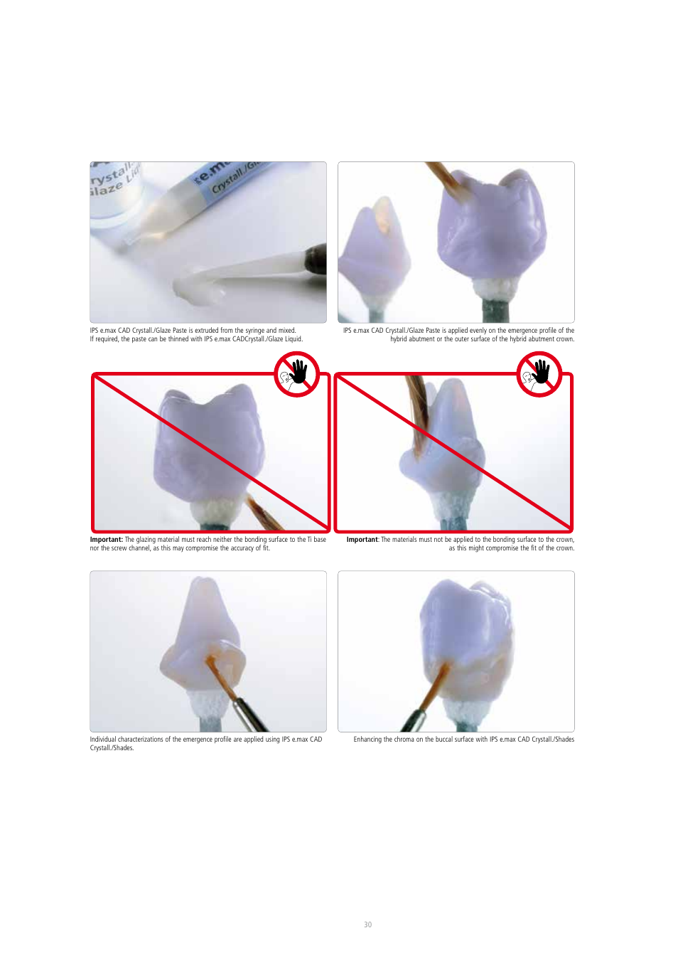 Ivoclar Vivadent IPS e.max CAD Abutment Solutions User Manual | Page 30 / 66