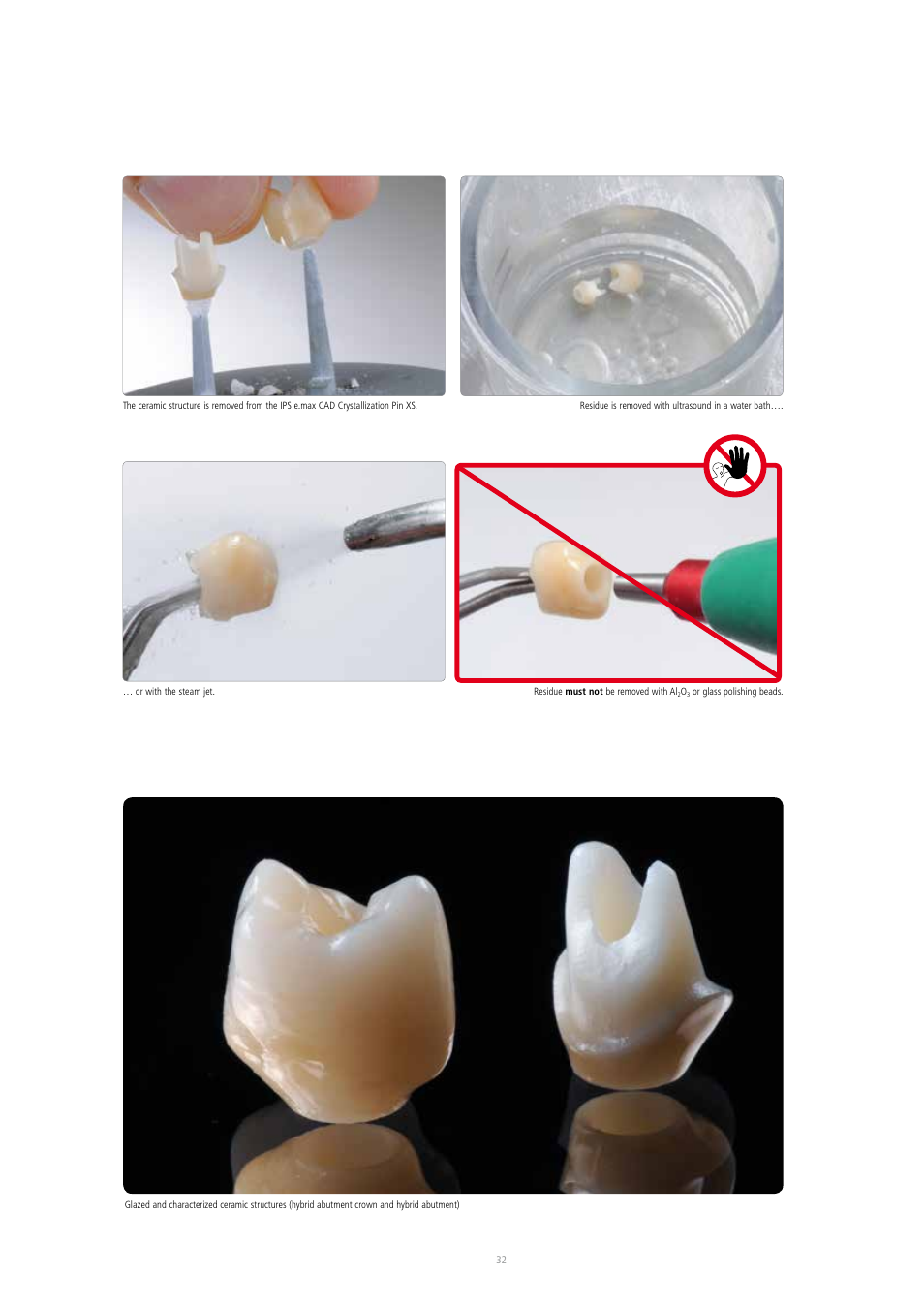 Ivoclar Vivadent IPS e.max CAD Abutment Solutions User Manual | Page 32 / 66