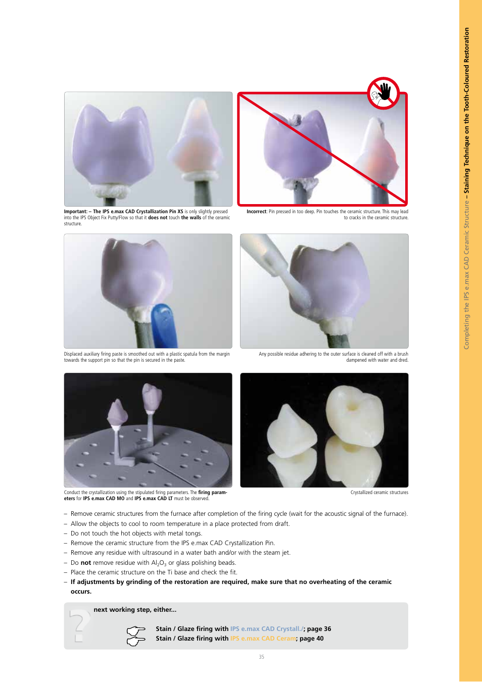 Ivoclar Vivadent IPS e.max CAD Abutment Solutions User Manual | Page 35 / 66