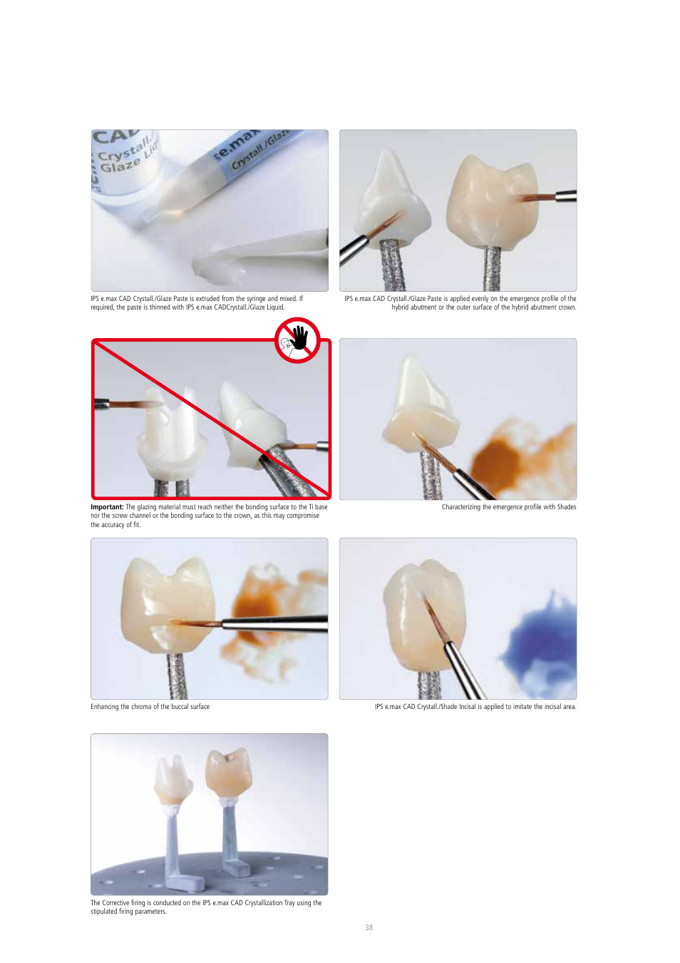 Ivoclar Vivadent IPS e.max CAD Abutment Solutions User Manual | Page 38 / 66