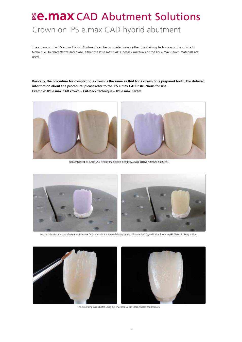 Cad abutment solutions, Crown on ips e.max cad hybrid abutment | Ivoclar Vivadent IPS e.max CAD Abutment Solutions User Manual | Page 44 / 66