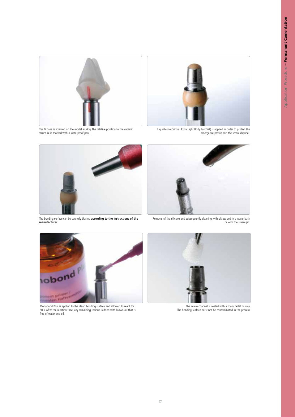 Ivoclar Vivadent IPS e.max CAD Abutment Solutions User Manual | Page 47 / 66