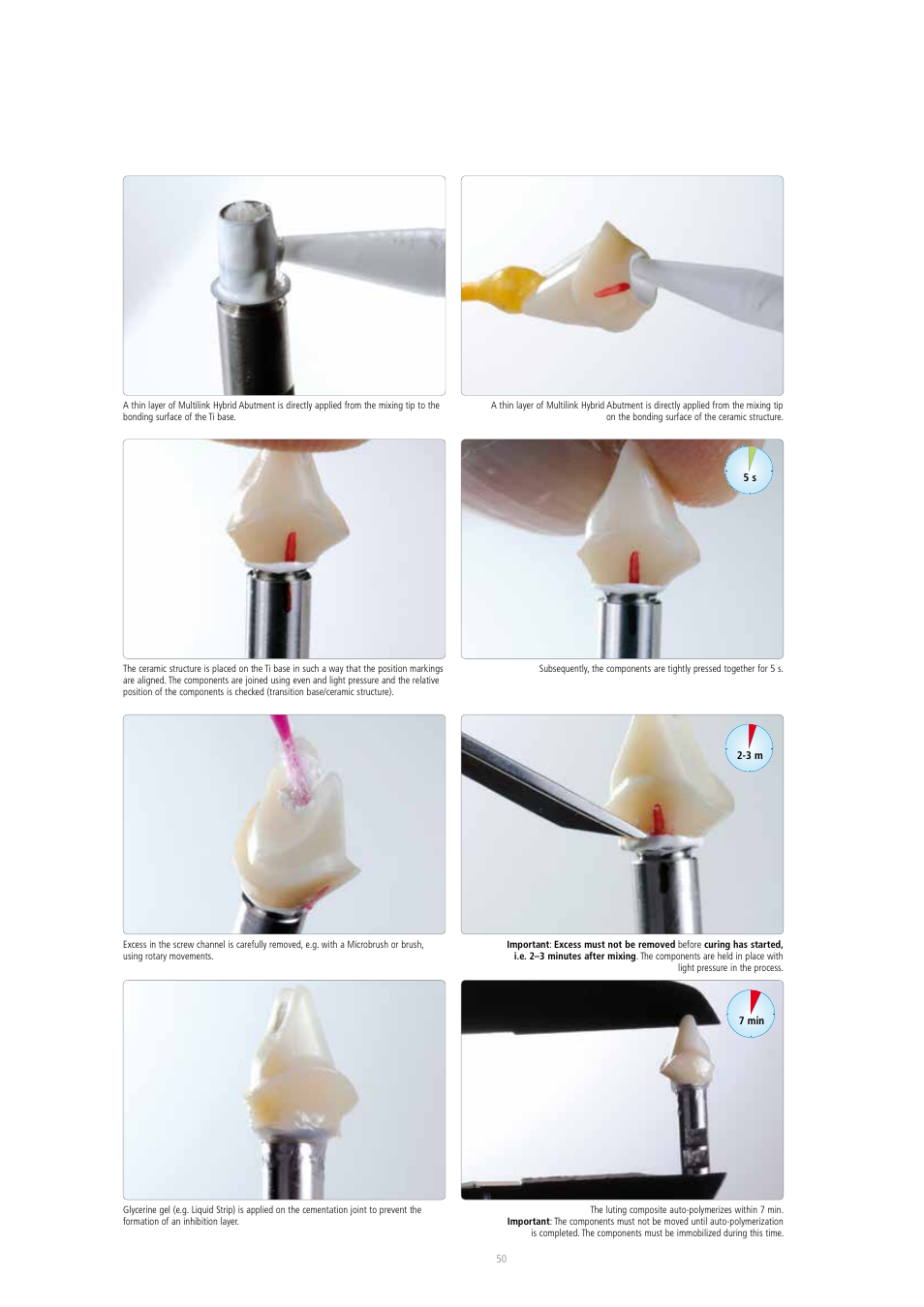 Ivoclar Vivadent IPS e.max CAD Abutment Solutions User Manual | Page 50 / 66