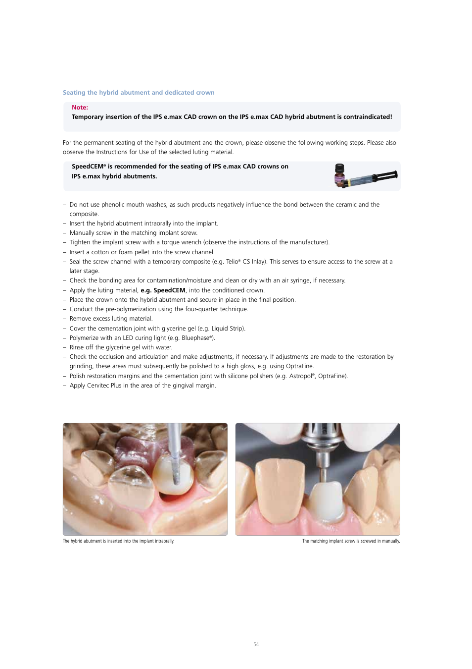Ivoclar Vivadent IPS e.max CAD Abutment Solutions User Manual | Page 54 / 66