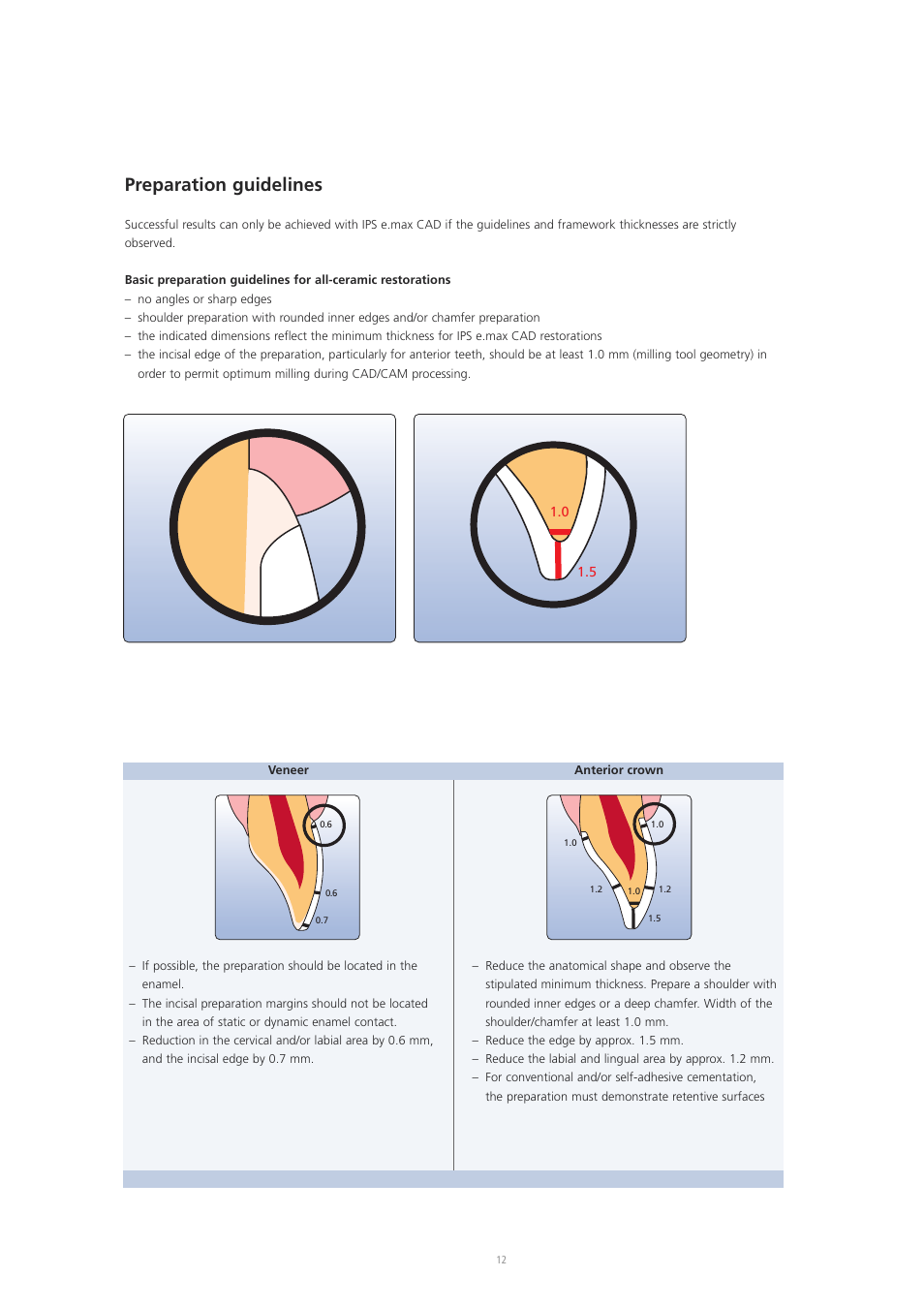 Preparation guidelines | Ivoclar Vivadent IPS e.max CAD Labside User Manual | Page 12 / 68