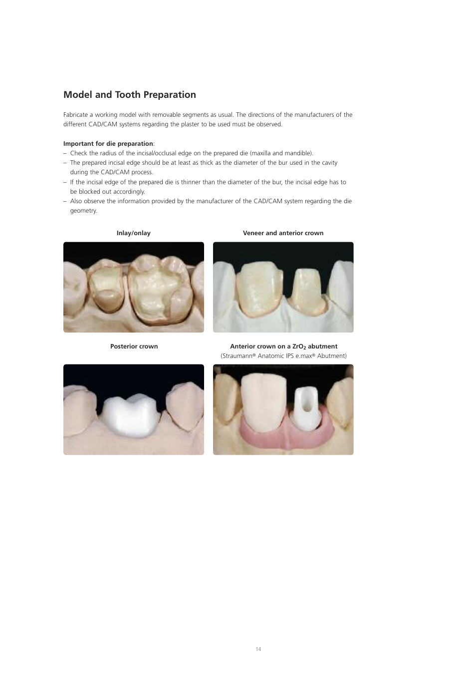 Model and tooth preparation | Ivoclar Vivadent IPS e.max CAD Labside User Manual | Page 14 / 68