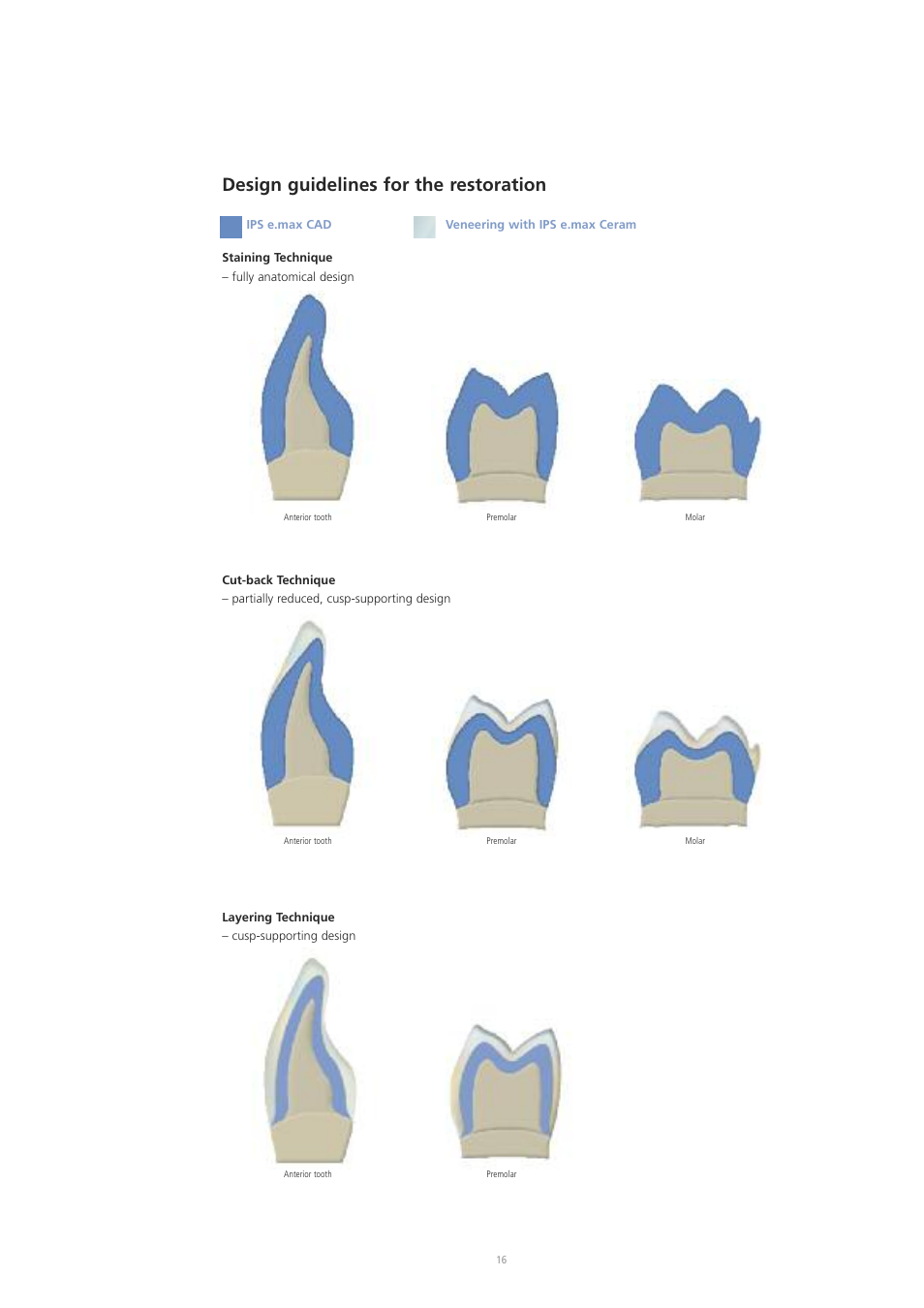 Design guidelines for the restoration | Ivoclar Vivadent IPS e.max CAD Labside User Manual | Page 16 / 68
