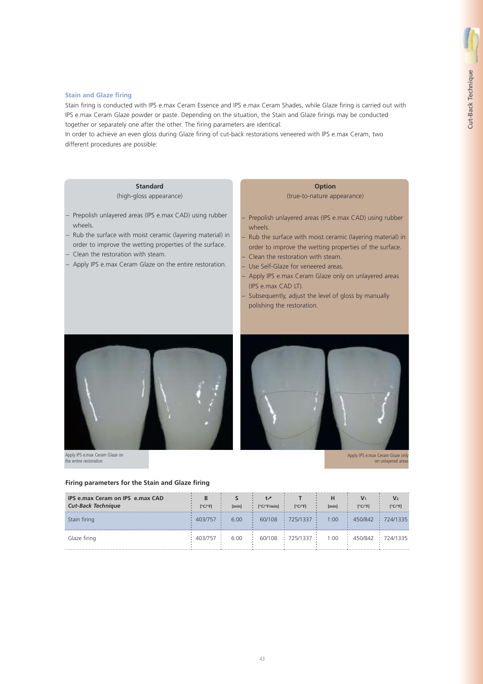 Ivoclar Vivadent IPS e.max CAD Labside User Manual | Page 43 / 68