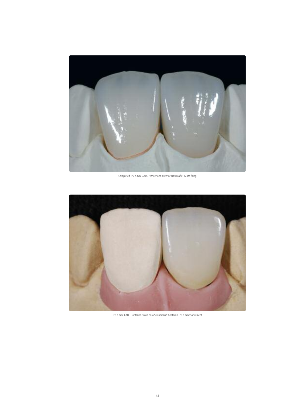 Ivoclar Vivadent IPS e.max CAD Labside User Manual | Page 44 / 68