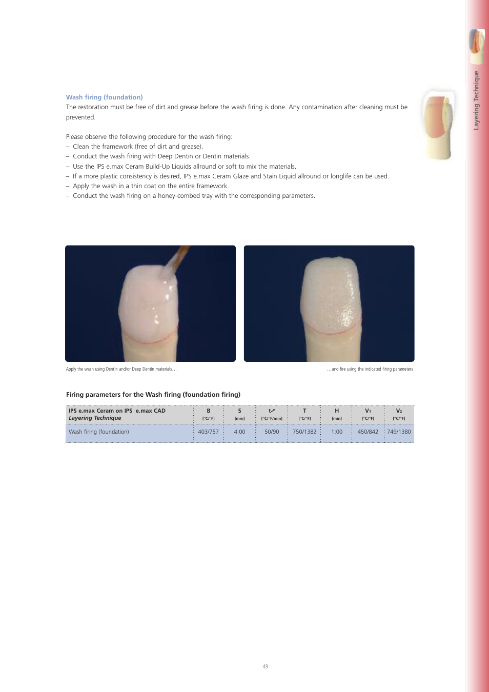 Ivoclar Vivadent IPS e.max CAD Labside User Manual | Page 49 / 68