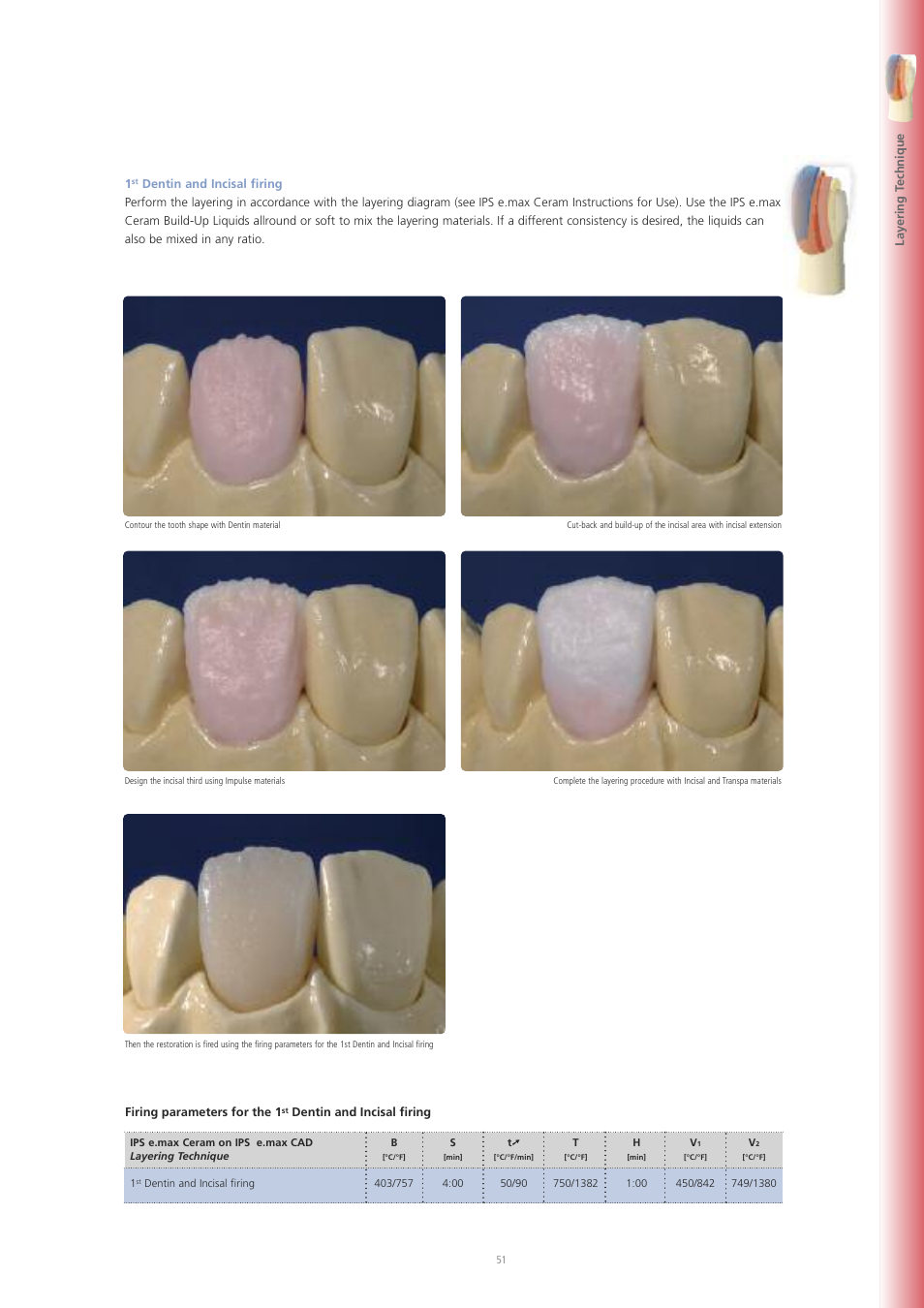 Ivoclar Vivadent IPS e.max CAD Labside User Manual | Page 51 / 68