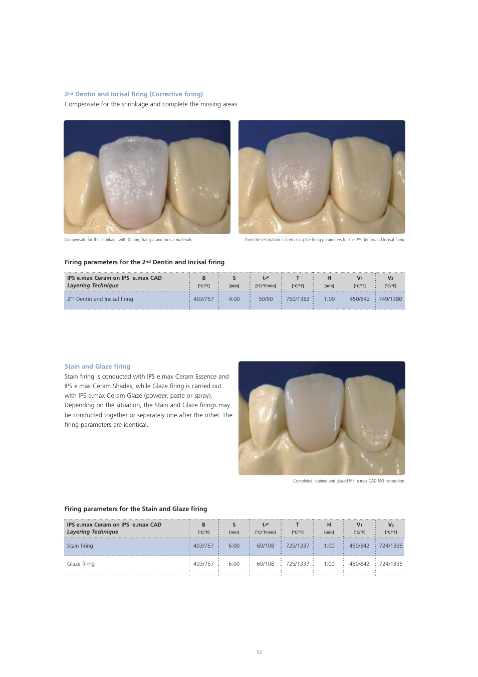 Ivoclar Vivadent IPS e.max CAD Labside User Manual | Page 52 / 68