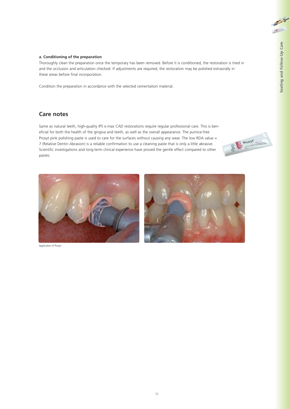 Ivoclar Vivadent IPS e.max CAD Labside User Manual | Page 55 / 68