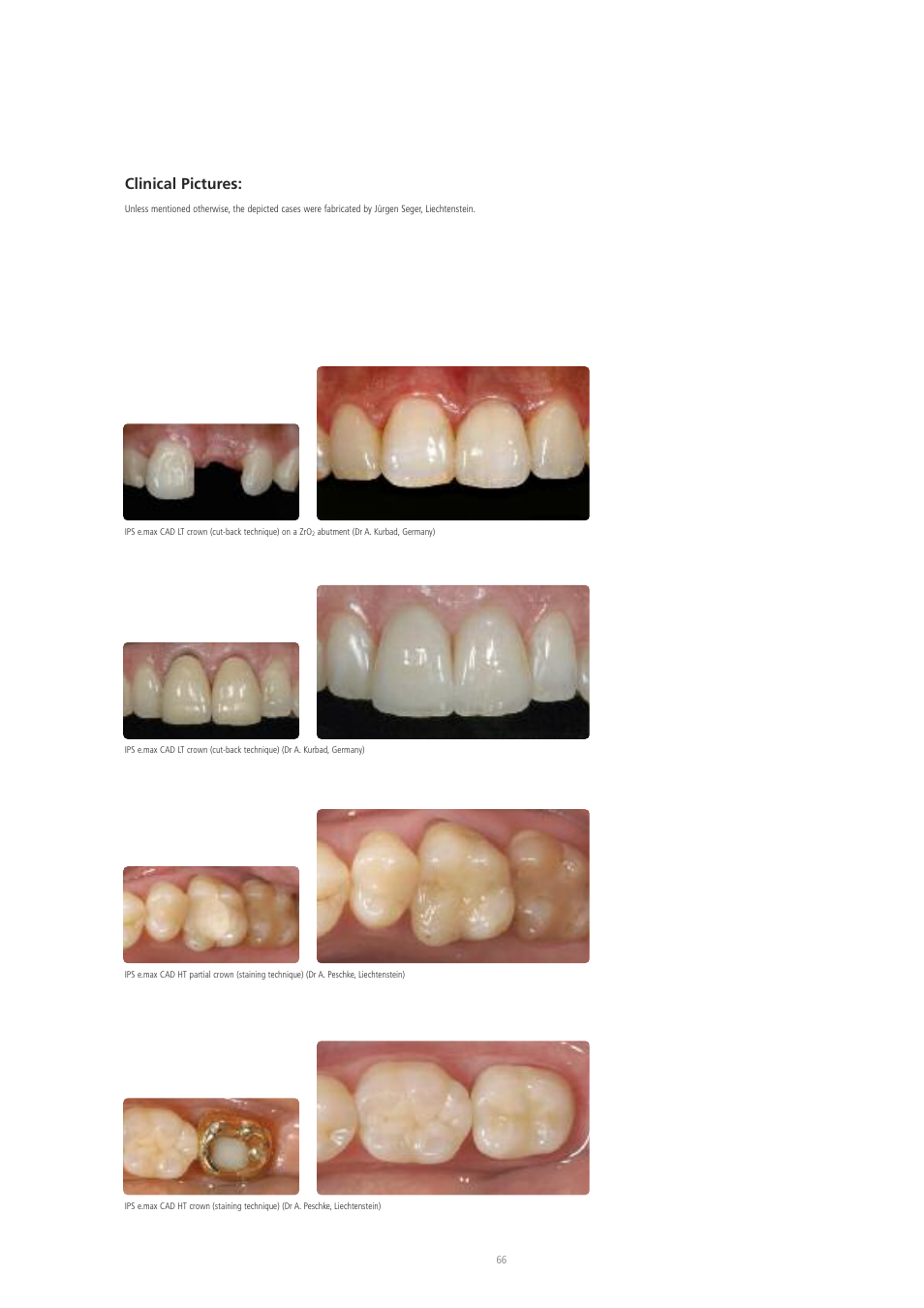 Clinical pictures | Ivoclar Vivadent IPS e.max CAD Labside User Manual | Page 66 / 68
