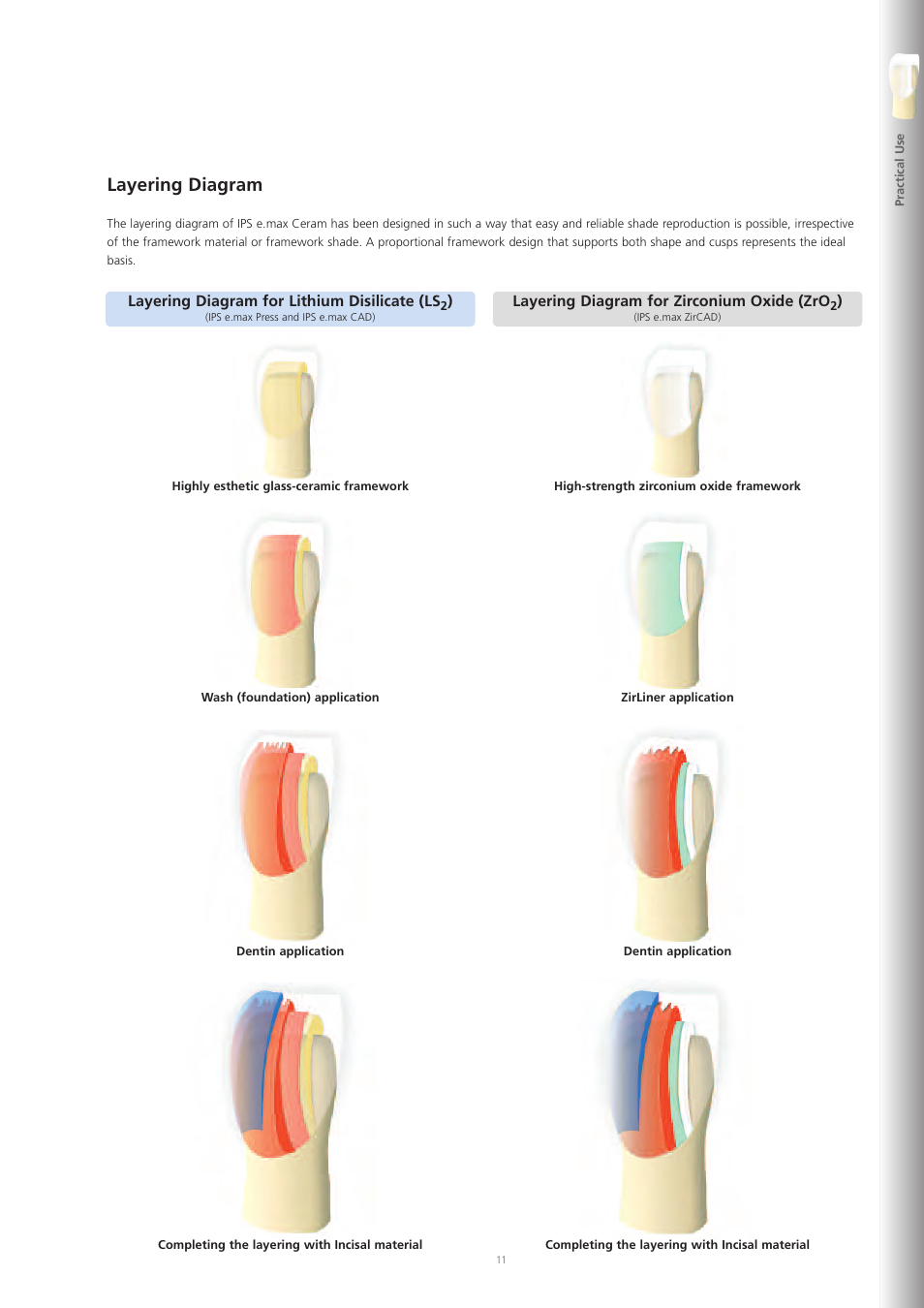 Layering diagram | Ivoclar Vivadent IPS e.max Ceram User Manual | Page 11 / 72
