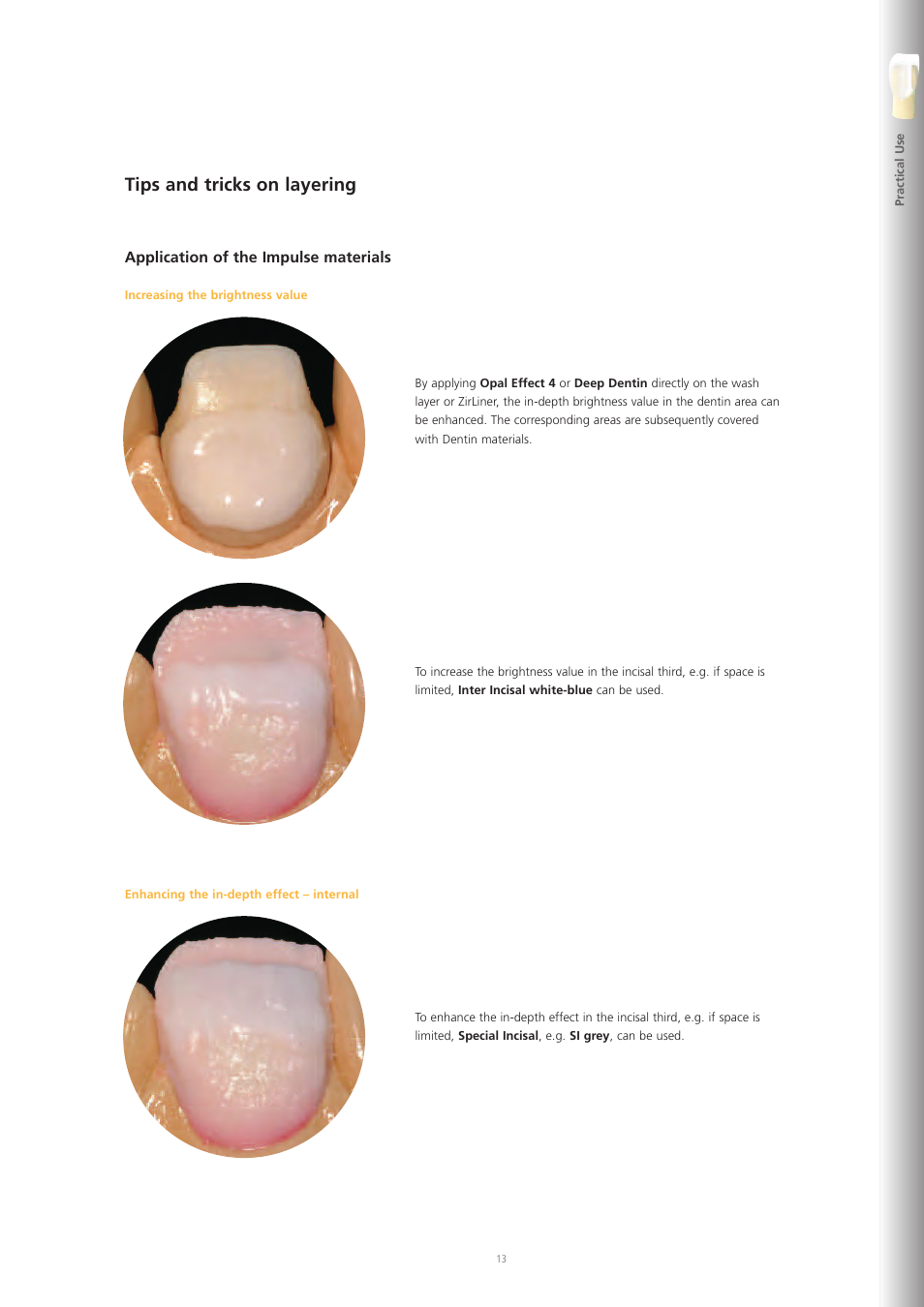 Tips and tricks on layering | Ivoclar Vivadent IPS e.max Ceram User Manual | Page 13 / 72