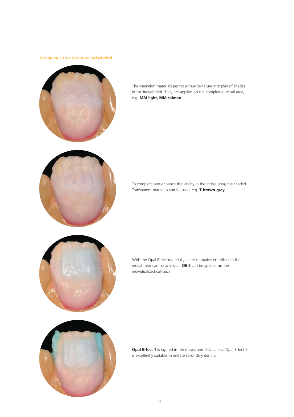 Ivoclar Vivadent IPS e.max Ceram User Manual | Page 14 / 72