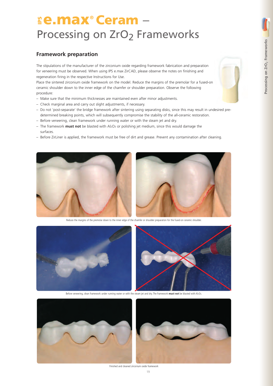 E.max, Ceram, Processing on zro | Frameworks | Ivoclar Vivadent IPS e.max Ceram User Manual | Page 19 / 72