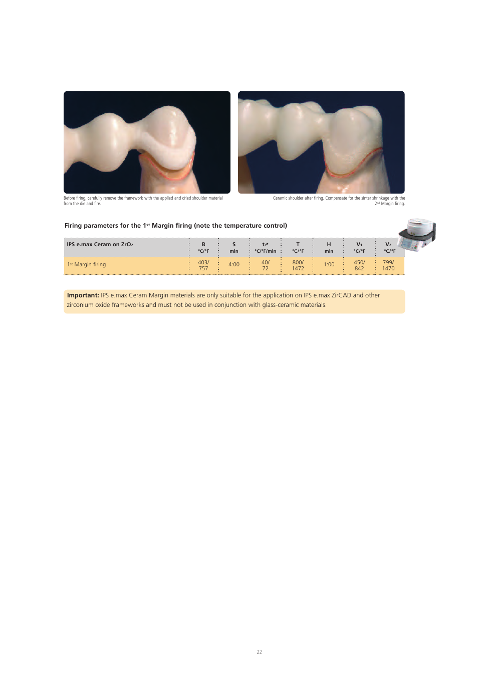 Ivoclar Vivadent IPS e.max Ceram User Manual | Page 22 / 72