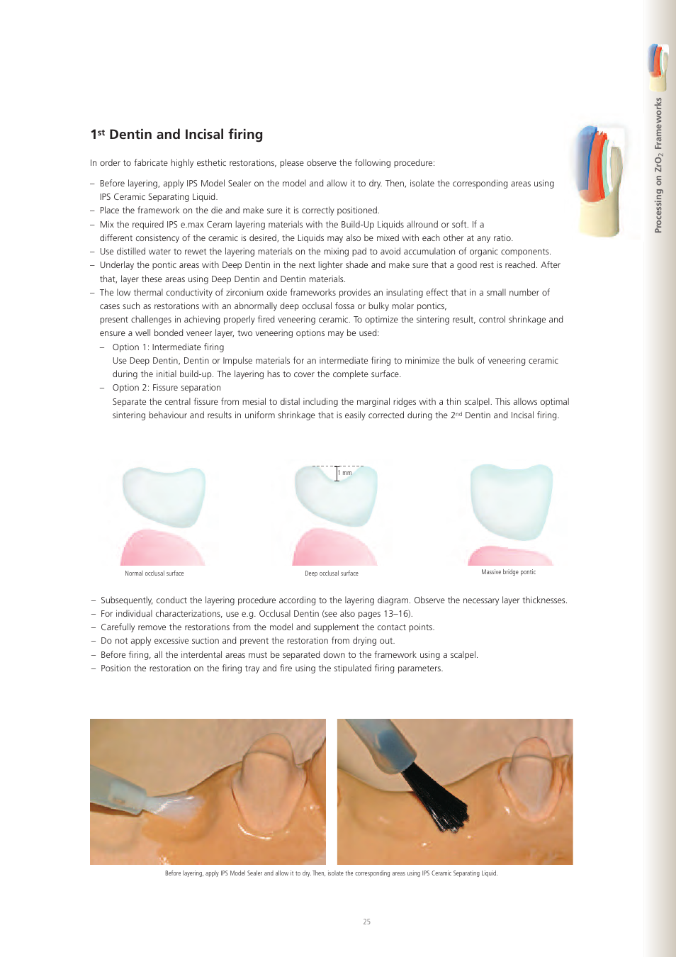 Dentin and incisal firing | Ivoclar Vivadent IPS e.max Ceram User Manual | Page 25 / 72