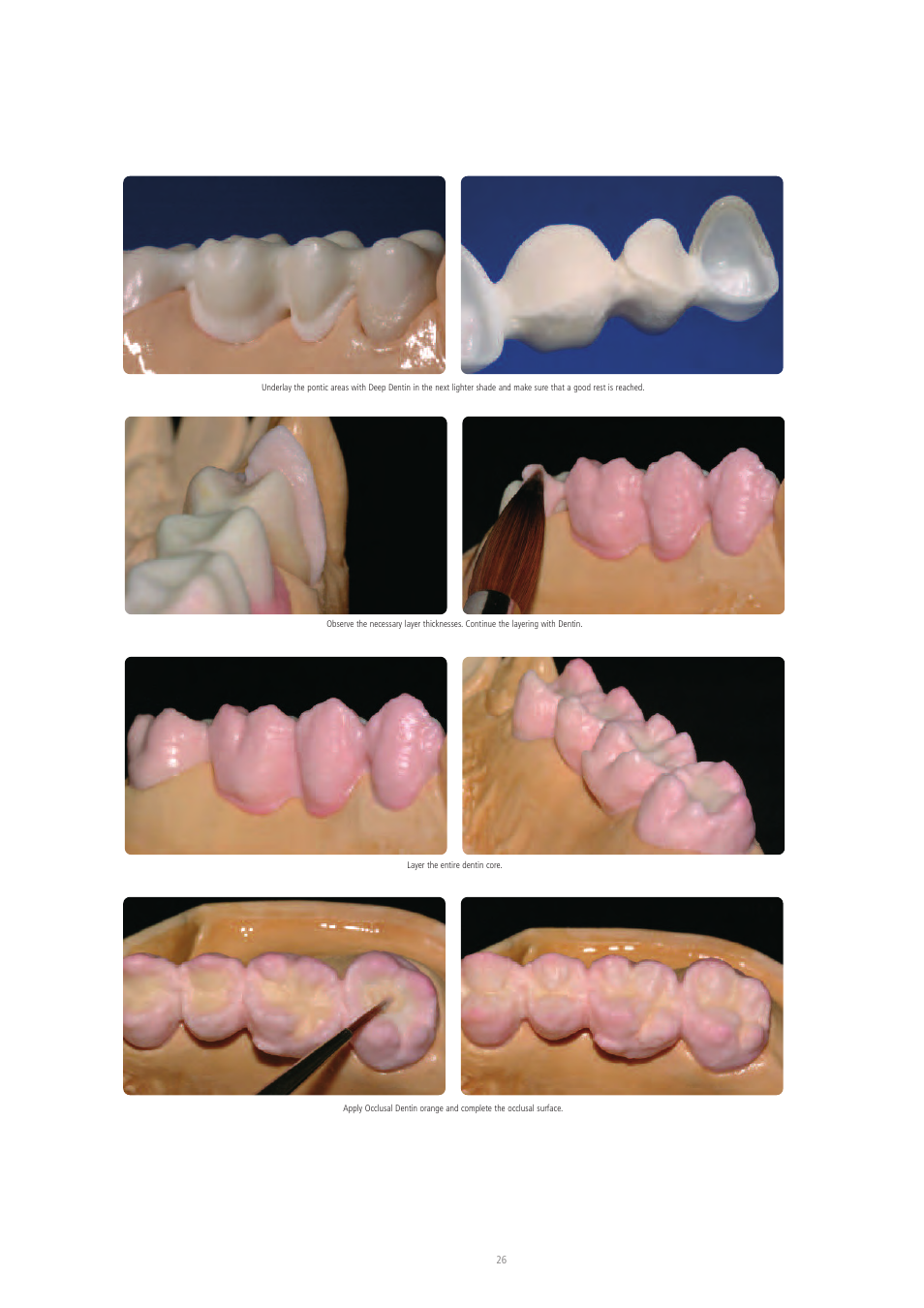 Ivoclar Vivadent IPS e.max Ceram User Manual | Page 26 / 72