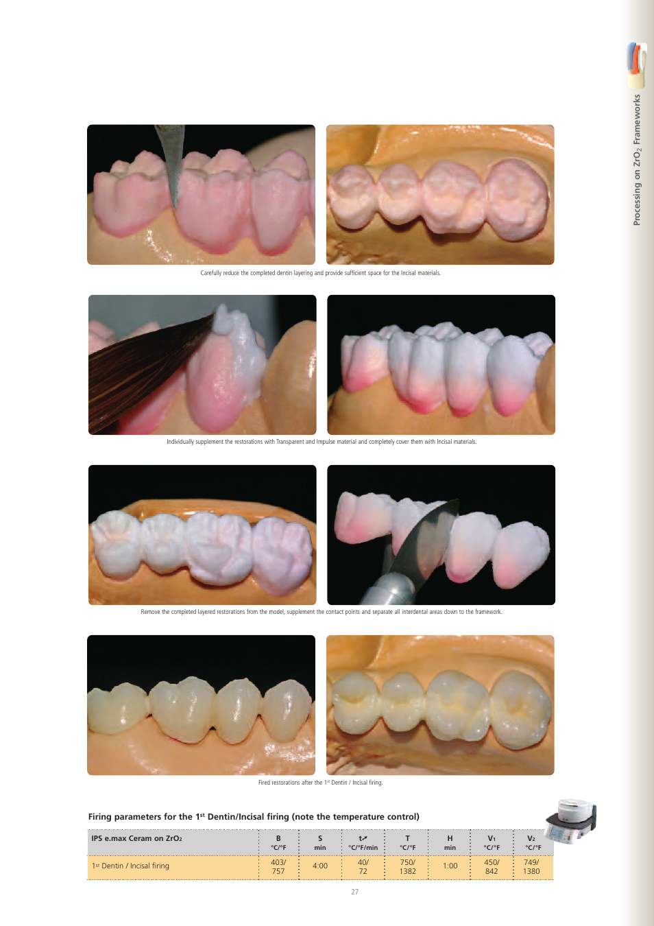 Ivoclar Vivadent IPS e.max Ceram User Manual | Page 27 / 72