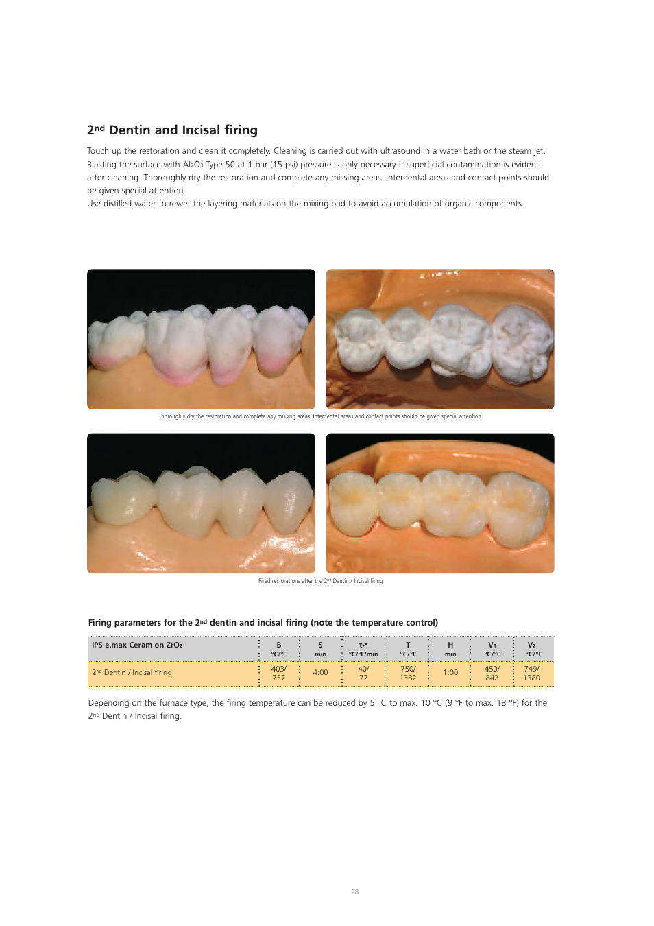 Dentin and incisal firing | Ivoclar Vivadent IPS e.max Ceram User Manual | Page 28 / 72