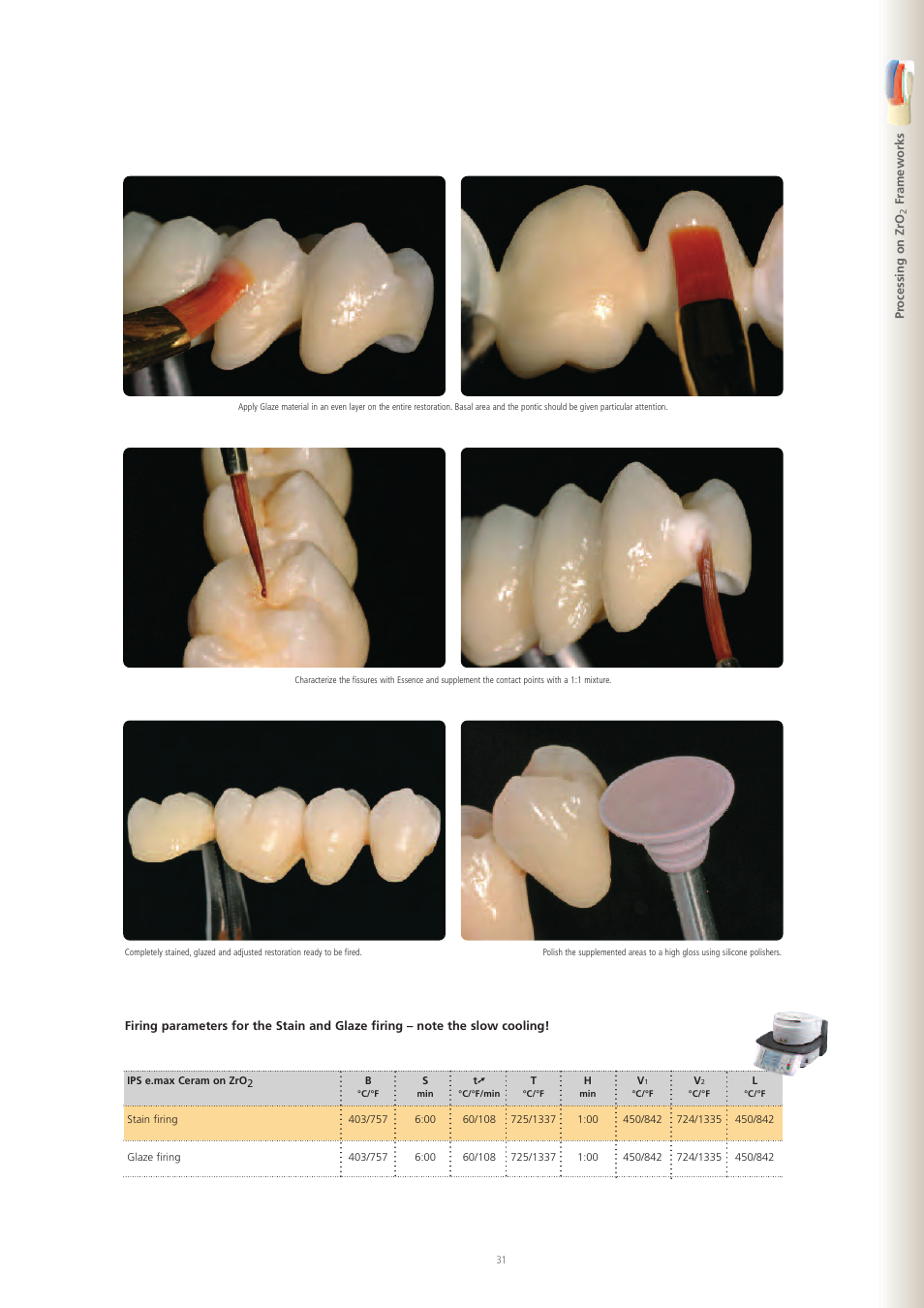 Ivoclar Vivadent IPS e.max Ceram User Manual | Page 31 / 72