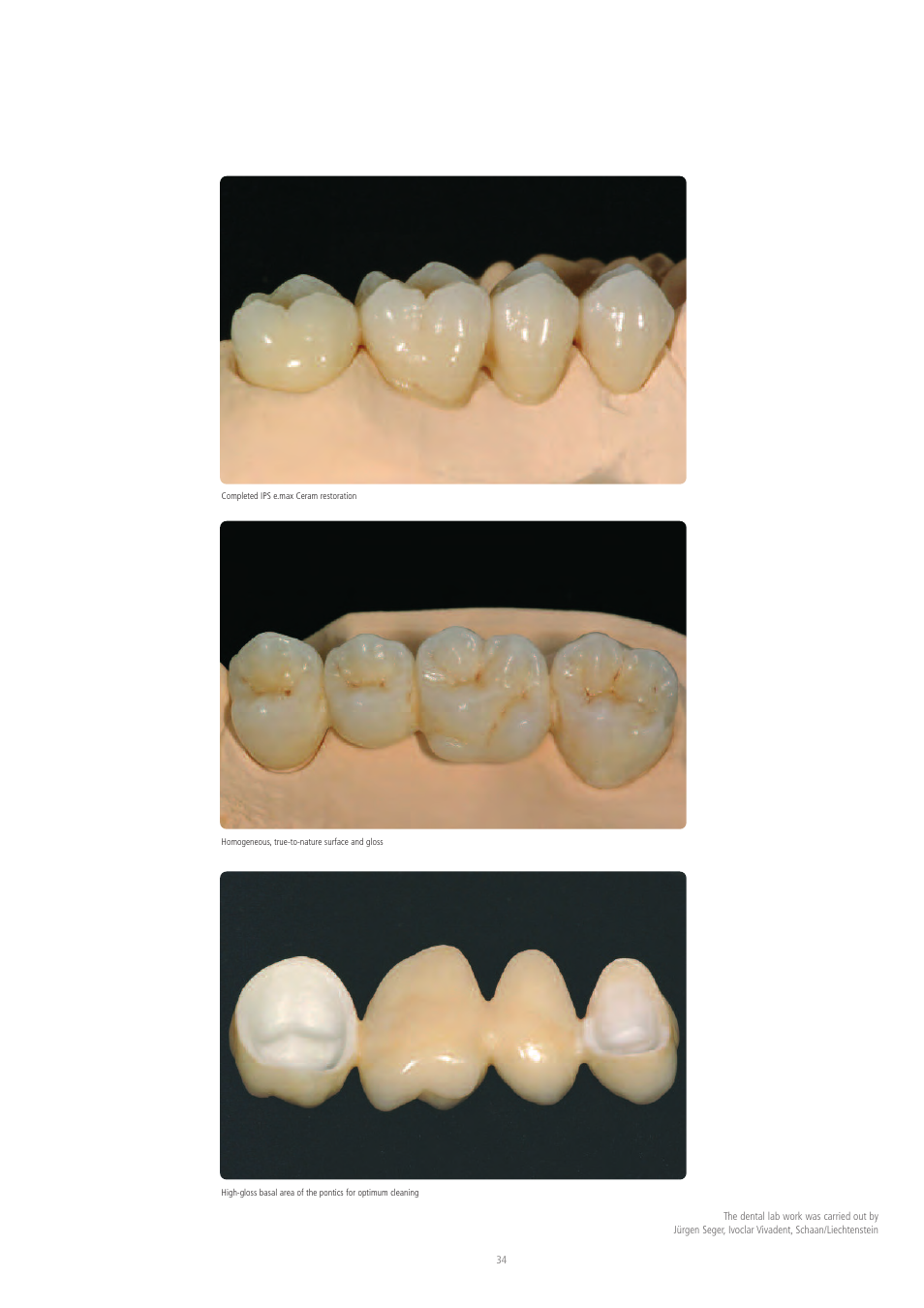 Ivoclar Vivadent IPS e.max Ceram User Manual | Page 34 / 72