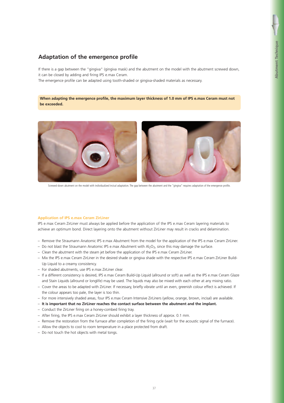 Adaptation of the emergence profile | Ivoclar Vivadent IPS e.max Ceram User Manual | Page 37 / 72